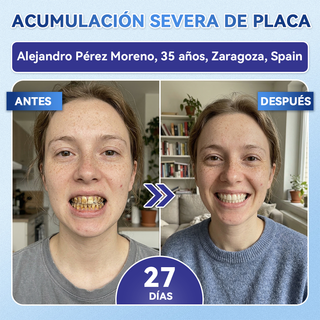 🦷𝐆𝐥𝐢𝐦𝐦𝐞𝐫𝐥𝐲®🎟️𝐓𝐢𝐝𝐞𝐠𝐥𝐮𝐬𝐢𝐛 𝐃𝐢𝐞𝐧𝐭𝐞𝐬 𝐘 𝐄𝐧𝐜í𝐚𝐬 𝐑𝐞𝐩𝐚𝐫𝐚𝐫 𝐌𝐢𝐜𝐫𝐨𝐧𝐞𝐞𝐝𝐥𝐞 𝐏𝐚𝐫𝐜𝐡𝐞 |𝑇𝑖𝑟𝑎𝑠 𝑑𝑒𝑛𝑡𝑎𝑙𝑒𝑠 𝑐𝑜𝑛 𝑡𝑒𝑐𝑛𝑜𝑙𝑜𝑔í𝑎 𝑎𝑣𝑎𝑛𝑧𝑎𝑑𝑎 𝑑𝑒 𝑎𝑐𝑡𝑖𝑣𝑎𝑐𝑖ó𝑛 𝑑𝑒 𝑐é𝑙𝑢𝑙𝑎𝑠 𝑚𝑎𝑑𝑟𝑒