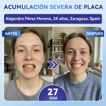 🦷𝐆𝐥𝐢𝐦𝐦𝐞𝐫𝐥𝐲®🎟️𝐓𝐢𝐝𝐞𝐠𝐥𝐮𝐬𝐢𝐛 𝐃𝐢𝐞𝐧𝐭𝐞𝐬 𝐘 𝐄𝐧𝐜í𝐚𝐬 𝐑𝐞𝐩𝐚𝐫𝐚𝐫 𝐌𝐢𝐜𝐫𝐨𝐧𝐞𝐞𝐝𝐥𝐞 𝐏𝐚𝐫𝐜𝐡𝐞 |𝑇𝑖𝑟𝑎𝑠 𝑑𝑒𝑛𝑡𝑎𝑙𝑒𝑠 𝑐𝑜𝑛 𝑡𝑒𝑐𝑛𝑜𝑙𝑜𝑔í𝑎 𝑎𝑣𝑎𝑛𝑧𝑎𝑑𝑎 𝑑𝑒 𝑎𝑐𝑡𝑖𝑣𝑎𝑐𝑖ó𝑛 𝑑𝑒 𝑐é𝑙𝑢𝑙𝑎𝑠 𝑚𝑎𝑑𝑟𝑒