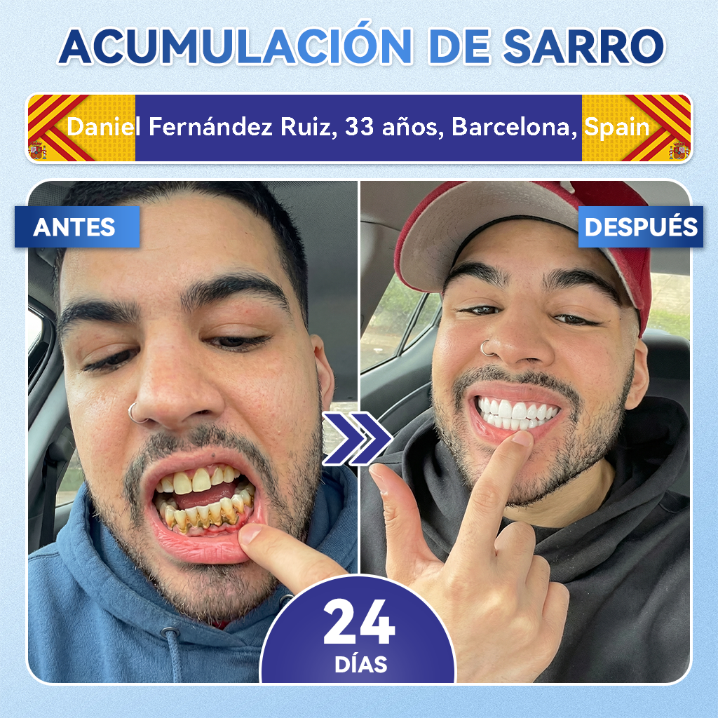𝐺𝑙𝑖𝑚𝑚𝑒𝑟𝑙𝑦®🎐💃𝑇𝑖𝑑𝑒𝑔𝑙𝑢𝑠𝑖𝑏: 𝑇𝑖𝑟𝑎𝑠 𝑏𝑢𝑐𝑎𝑙𝑒𝑠 𝑑𝑒 𝑑𝑖𝑠𝑜𝑙𝑢𝑐𝑖ó𝑛 𝑟á𝑝𝑖𝑑𝑎 𝑝𝑎𝑟𝑎 𝑙𝑎 𝑟𝑒𝑝𝑎𝑟𝑎𝑐𝑖ó𝑛 𝑑𝑒 𝑑𝑖𝑒𝑛𝑡𝑒𝑠 𝑦 𝑒𝑛𝑐í𝑎𝑠.