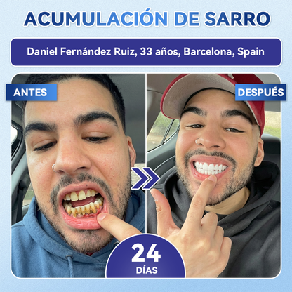 🦷𝐆𝐥𝐢𝐦𝐦𝐞𝐫𝐥𝐲®🎟️𝐓𝐢𝐝𝐞𝐠𝐥𝐮𝐬𝐢𝐛 𝐃𝐢𝐞𝐧𝐭𝐞𝐬 𝐘 𝐄𝐧𝐜í𝐚𝐬 𝐑𝐞𝐩𝐚𝐫𝐚𝐫 𝐌𝐢𝐜𝐫𝐨𝐧𝐞𝐞𝐝𝐥𝐞 𝐏𝐚𝐫𝐜𝐡𝐞 |𝑇𝑖𝑟𝑎𝑠 𝑑𝑒𝑛𝑡𝑎𝑙𝑒𝑠 𝑐𝑜𝑛 𝑡𝑒𝑐𝑛𝑜𝑙𝑜𝑔í𝑎 𝑎𝑣𝑎𝑛𝑧𝑎𝑑𝑎 𝑑𝑒 𝑎𝑐𝑡𝑖𝑣𝑎𝑐𝑖ó𝑛 𝑑𝑒 𝑐é𝑙𝑢𝑙𝑎𝑠 𝑚𝑎𝑑𝑟𝑒