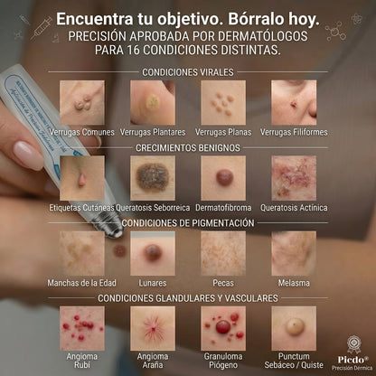 𝐏𝐢𝐜𝐝𝐨® 🚢Borrador de Verrugas y Manchas en 7 Días (𝐀𝐩𝐥𝐢𝐜𝐚𝐝𝐨𝐫 𝐫𝐨𝐥𝐥-𝐨𝐧: 𝐬𝐢𝐧 𝐝𝐨𝐥𝐨𝐫 𝐧𝐢 𝐜𝐢𝐜𝐚𝐭𝐫𝐢𝐜𝐞𝐬)✨