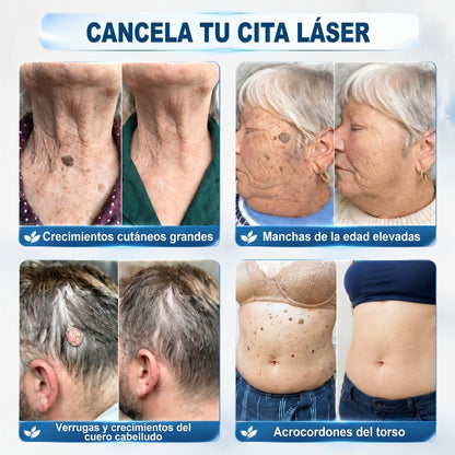 𝐏𝐢𝐜𝐝𝐨® 🚢Borrador de Verrugas y Manchas en 7 Días (𝐀𝐩𝐥𝐢𝐜𝐚𝐝𝐨𝐫 𝐫𝐨𝐥𝐥-𝐨𝐧: 𝐬𝐢𝐧 𝐝𝐨𝐥𝐨𝐫 𝐧𝐢 𝐜𝐢𝐜𝐚𝐭𝐫𝐢𝐜𝐞𝐬)✨