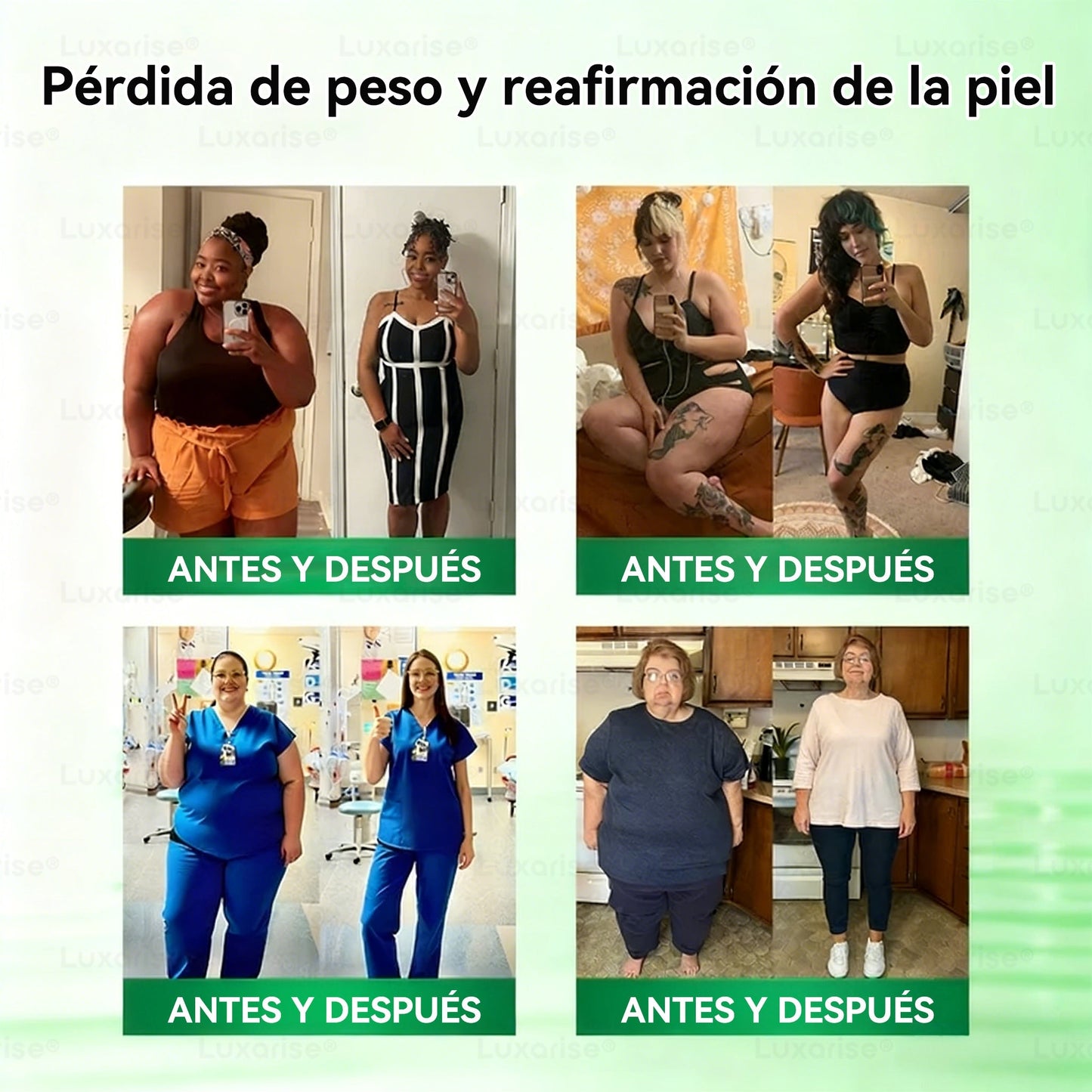 𝑻𝒊𝒆𝒏𝒅𝒂 𝑶𝒇𝒊𝒄𝒊𝒂𝒍  |🥐𝑳𝒖𝒙𝒂𝒓𝒊𝒔𝒆® 10 𝑬𝑵 1 𝑴𝒐𝒓𝒊𝒏𝒈𝒂 𝒀 𝑩𝒆𝒓14𝒃𝒆𝒓𝒊𝒏𝒂 𝑷𝒂𝒓𝒄𝒉𝒆 𝑨𝒗𝒂𝒏𝒛𝒂𝒅𝒐 𝑫𝒆 𝑴𝒊𝒄𝒓𝒐𝒏𝒆𝒆𝒅𝒍𝒆𝒔 𝑵𝒂𝒏𝒐（𝑼𝒏𝒂 𝒗𝒆𝒛 𝒂𝒍 𝒅í𝒂, 𝒄𝒂𝒎𝒃𝒊𝒐𝒔 𝒗𝒊𝒔𝒊𝒃𝒍𝒆𝒔 𝒆𝒏 7 𝒅í𝒂𝒔） ✅ 𝑶𝒃𝒆𝒔𝒊𝒅𝒂𝒅, 𝑫𝒊𝒂𝒃𝒆𝒕𝒆𝒔, 𝑨𝒑𝒏𝒆𝒂 𝒅𝒆𝒍 𝑺𝒖𝒆ñ𝒐 𝒚 𝑷𝒓𝒐𝒃𝒍𝒆𝒎𝒂𝒔 𝑨𝒓𝒕𝒊𝒄𝒖𝒍𝒂𝒓𝒆𝒔