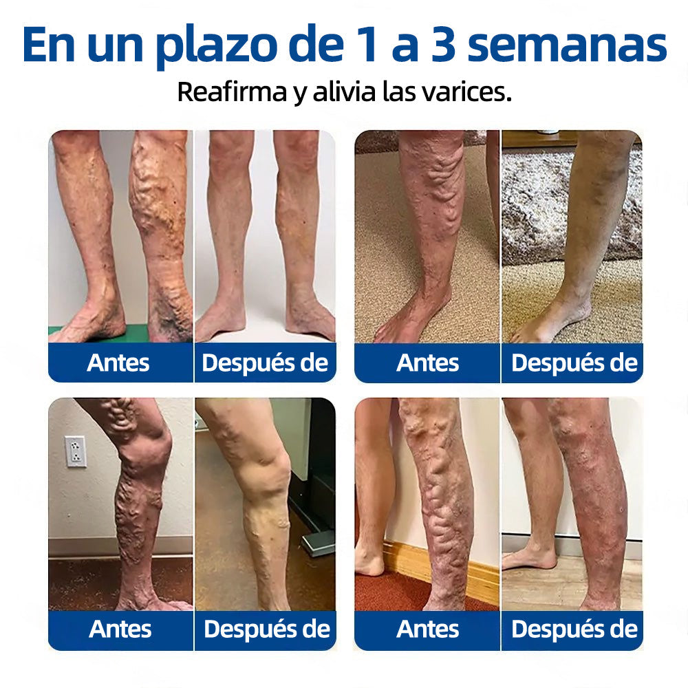 ✅𝐅𝐥𝐨𝐫𝐢𝐬𝐦𝐚®🌽🩸𝐎𝐛𝐣𝐞𝐭𝐢𝐯𝐨 𝐕𝐞𝐧𝐨𝐬𝐨 𝐏𝐚𝐫𝐜𝐡𝐞 𝐃𝐞 𝐌𝐢𝐜𝐫𝐨𝐚𝐠𝐮𝐣𝐚𝐬⚡Alivio instantáneo, resultados a largo plazo