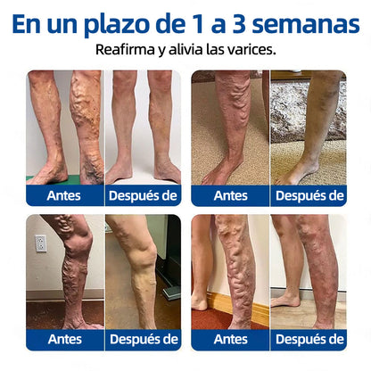 ✅𝐅𝐥𝐨𝐫𝐢𝐬𝐦𝐚®🌽🩸𝐎𝐛𝐣𝐞𝐭𝐢𝐯𝐨 𝐕𝐞𝐧𝐨𝐬𝐨 𝐏𝐚𝐫𝐜𝐡𝐞 𝐃𝐞 𝐌𝐢𝐜𝐫𝐨𝐚𝐠𝐮𝐣𝐚𝐬⚡Alivio instantáneo, resultados a largo plazo