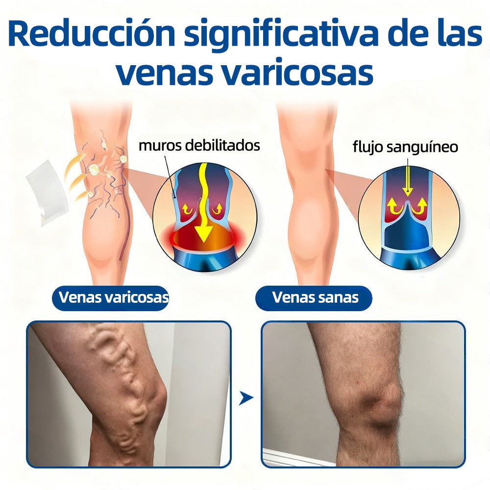 ✅𝐅𝐥𝐨𝐫𝐢𝐬𝐦𝐚®🌽🩸𝐎𝐛𝐣𝐞𝐭𝐢𝐯𝐨 𝐕𝐞𝐧𝐨𝐬𝐨 𝐏𝐚𝐫𝐜𝐡𝐞 𝐃𝐞 𝐌𝐢𝐜𝐫𝐨𝐚𝐠𝐮𝐣𝐚𝐬⚡Alivio instantáneo, resultados a largo plazo